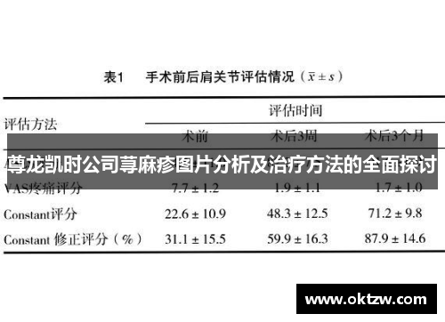 尊龙凯时公司荨麻疹图片分析及治疗方法的全面探讨